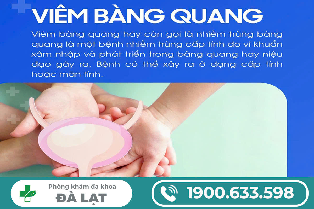 Hình ảnh minh họa
